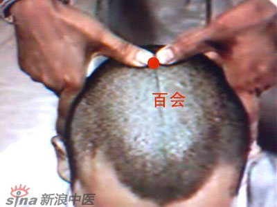 艾灸常用的保健穴有哪些？--百會