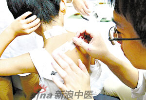 灸法的種類  你知道多少？